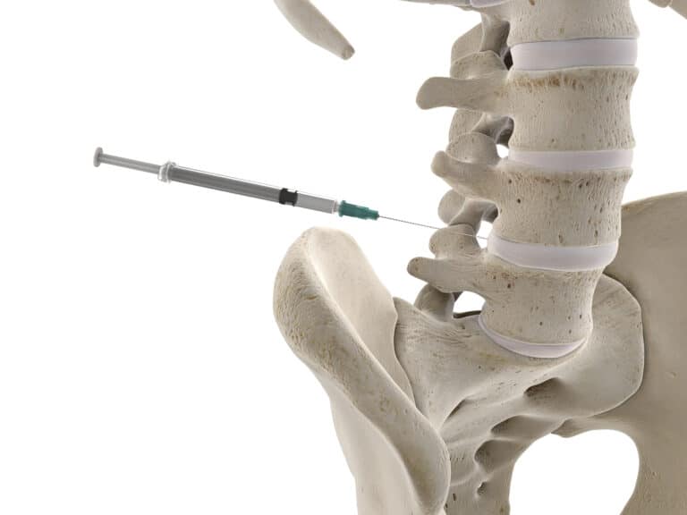 Intradiscal Steroid Injections Everything You Need to Know Spine Info