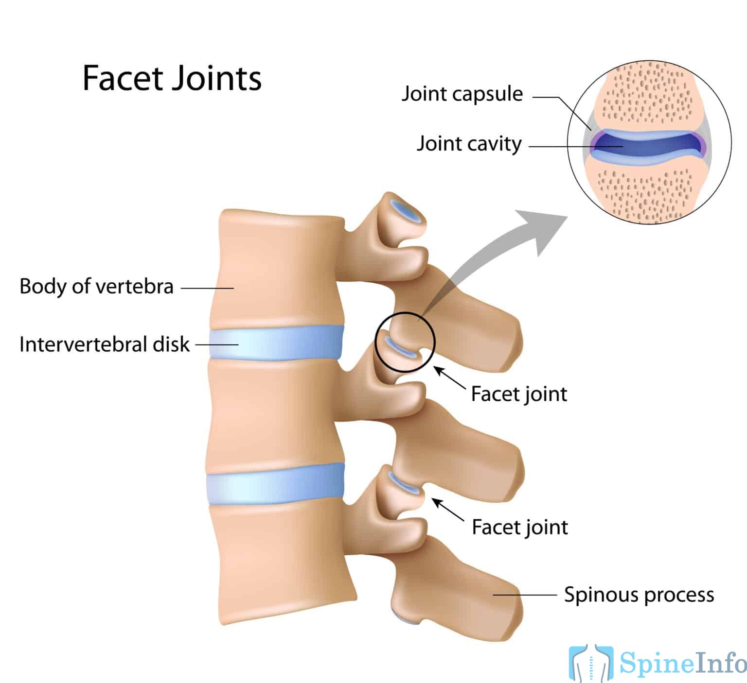 Facet Joint Injections Everything You Need To Know Spine Info